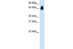 WB Suggested Anti-TRIM32 Antibody Titration:  1. (TRIM32 Antikörper  (C-Term))