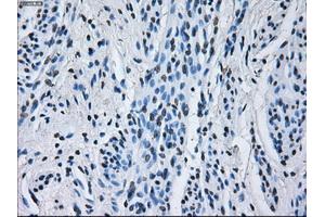 Immunohistochemical staining of paraffin-embedded Kidney tissue using anti-RNF144Bmouse monoclonal antibody. (RNF144B Antikörper  (AA 1-256))