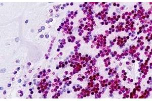 Human Brain, Cerebellum: Formalin-Fixed, Paraffin-Embedded (FFPE) (PDX1 Antikörper  (AA 27-76))