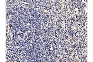 IHC analysis of Kinectin 1/KTN1 using anti-Kinectin 1/KTN1 antibody (ABIN7601096). (KTN1 Antikörper  (AA 283-827))