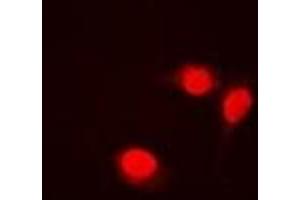 Immunofluorescent analysis of Transketolase staining in Jurkat cells.