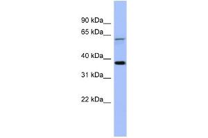 WB Suggested Anti-MAGEB1 Antibody Titration: 0.