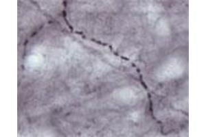 Immunohistochemistry (IHC) image for anti-Solute Carrier Family 17 (Vesicular Glutamate Transporter), Member 7 (SLC17A7) antibody (ABIN351379)