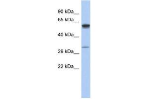 WB Suggested Anti-ZDHHC24 Antibody Titration: 0. (ZDHHC24 Antikörper  (Middle Region))