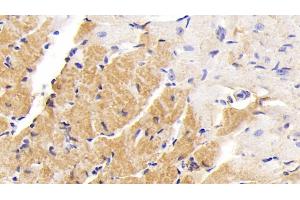 Immunohistochemistry (IHC) image for anti-Procollagen III N-Terminal Propeptide (PIIINP) (AA 24-154) antibody (ABIN7445201)
