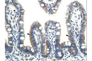 Image no. 1 for anti-BTB (POZ) Domain Containing 6 (BTBD6) (AA 87-136) antibody (ABIN202456)