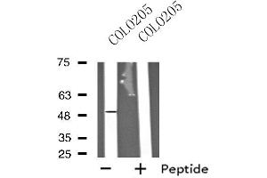 Western blot analysis of extracts from COLO205 cells, using HRH3 antibody.
