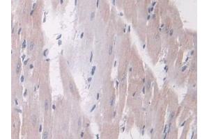 Immunohistochemistry (IHC) image for anti-Angiopoietin 1 (ANGPT1) (AA 304-450) antibody (ABIN7430330)