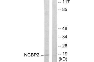 Western blot analysis of extracts from COLO205 cells, using NCBP2 antibody. (NCBP2 Antikörper  (N-Term))