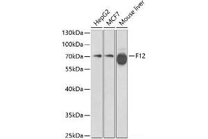Western blot analysis of extracts of various cell lines using F12 Polyclonal Antibody at dilution of 1:1000. (F12 Antikörper)