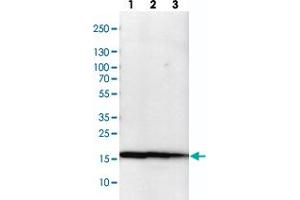 Western blot analysis of cell lysates with NME1-NME2 polyclonal antibody  at 1:100-1:500 dilution.