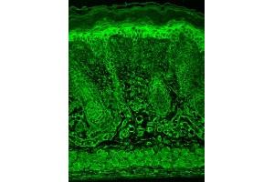 Immunohistochemistry (IHC) image for anti-Hypoxia Inducible Factor 1, alpha Subunit (Basic Helix-Loop-Helix Transcription Factor) (HIF1A) (AA 329-530) antibody (ABIN863097)