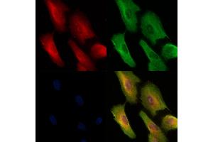 Phospho-RIP3 (Thr187) Antibody staining A549 cells(H2O2 treatment) by IF/ICC.