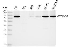 Western blot analysis of PKC alpha using anti-PKC alpha antibody (ABIN3043549). (PKC alpha Antikörper  (AA 153-342))