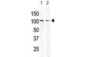cKit antibody used in western blot to detect KIT in serum-starved HeLa cell lysate (lane 1) and primate testis tissue lysate (2). (KIT Antikörper  (AA 9-40))