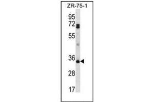 Western blot analysis of CD273 / PDL2 Antibody (N-term) Cat. (PDCD1LG2 Antikörper  (N-Term))