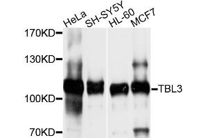Western blot analysis of extracts of various cell lines, using TBL3 antibody (ABIN6003750) at 1/1000 dilution. (TBL3 Antikörper)