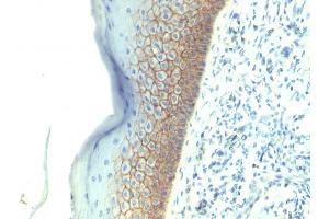 Immunohistochemistry (IHC) image for anti-Cadherin 1, Type 1, E-Cadherin (Epithelial) (CDH1) antibody (ABIN6941296)