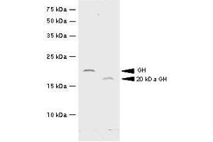 Recombinant hGH and 20kDa hGH were resolved by electrophoresis, transferred to PVDF membrane and probed with anti-hGH(1:500). (Growth Hormone 1 Antikörper  (AA 27-217))