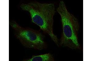 Immunocytochemistry (ICC) image for anti-Signal Transducer and Activator of Transcription 5A (STAT5A) (AA 583-794) antibody (ABIN1845625) (STAT5A Antikörper  (AA 583-794))