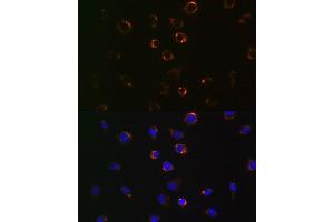 Immunofluorescence analysis of L929 cells using VD antibody (ABIN7271335). (VDAC1 Antikörper)
