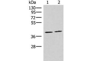 Western blot analysis of Human placenta tissue and Human fetal brain tissue lysates using HMGCLL1 Polyclonal Antibody at dilution of 1:1000