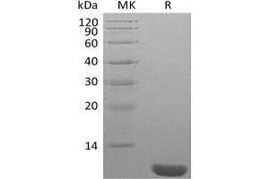 Western Blotting (WB) image for Neural Precursor Cell Expressed, Developmentally Down-Regulated 8 (NEDD8) protein (ABIN7319921) (NEDD8 Protein)