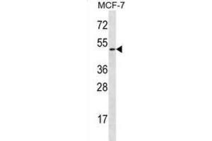 Western Blotting (WB) image for anti-Ladinin 1 (LAD1) antibody (ABIN2996996)