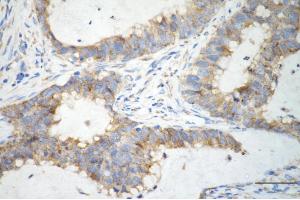 anti-Peroxiredoxin 4 (PRDX4) antibody