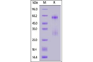 SARS-CoV-2 Nucleocapsid protein, His Tag on  under reducing (R) condition. (SARS-CoV-2 Nucleocapsid Protein (SARS-CoV-2 N) (His tag))