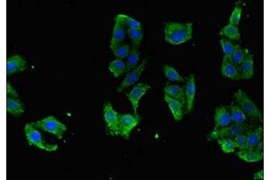 Immunofluorescent analysis of HepG2 cells using ABIN7167163 at dilution of 1:100 and Alexa Fluor 488-congugated AffiniPure Goat Anti-Rabbit IgG(H+L) (RASGRP1 Antikörper  (AA 594-716))