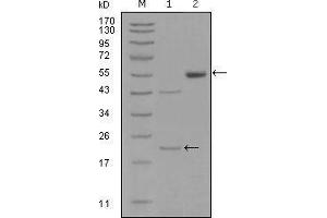 Western blot analysis using EPHA5 mouse mAb against truncated EPHA5-His recombinant protein (1) and truncated EPHA5(aa620-774)-hIgGFc transfected CHO-K1 cell lysate(2). (EPH Receptor A5 Antikörper  (AA 620-774))