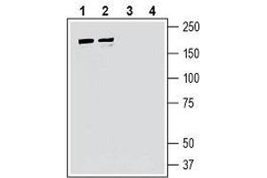 Western blot analysis of human Jurkat T-cell leukemia cell line lysate (lanes 1 and 3) and human  breast adenocarcinoma cell line lysate (lanes 2 and 4):1, 2. (IQ Motif Containing GTPase Activating Protein 1 (IQGAP1) Peptid)