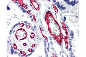 Anti-CD34 antibody IHC of human placenta.