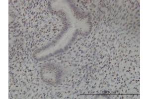Image no. 4 for anti-NIMA (Never In Mitosis Gene A)-Related Kinase 11 (NEK11) (AA 1-483) antibody (ABIN599307) (NEK11 Antikörper  (AA 1-483))