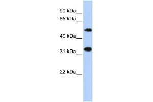 WB Suggested Anti-C6orf150 Antibody Titration: 0. (C6orf150 Antikörper  (Middle Region))