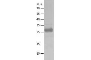 Hepcidin Protein (AA 24-84) (His-IF2DI Tag)