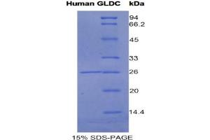 SDS-PAGE analysis of Human Glycine Dehydrogenase Protein. (GLDC Protein)