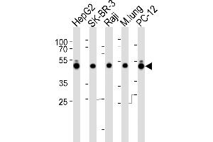 Western blot analysis of lysates from HepG2, SK-BR-3, Raji cell line, mouse lung tissue lysate and rat PC-12 cell line (from left to right), using DNAJA1 Antibody (C-term) (ABIN6242850 and ABIN6577522). (DNAJA1 Antikörper  (C-Term))