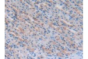 Detection of NT-ProANP in Rat Stomach Tissue using Polyclonal Antibody to N-Terminal Pro-Atrial Natriuretic Peptide (NT-ProANP) (PRO-ANP Antikörper  (AA 25-122))