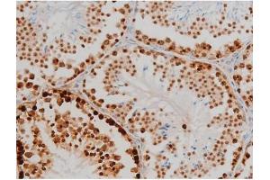 ABIN6267398 at 1/200 staining Mouse testis tissue sections by IHC-P. (H2AFX Antikörper  (pSer139))