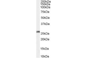 Image no. 1 for anti-Gap Junction Protein, beta 2, 26kDa (GJB2) (C-Term) antibody (ABIN374836) (GJB2 Antikörper  (C-Term))