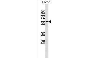 Western Blotting (WB) image for anti-Rab9 Effector Protein with Kelch Motifs (RABEPK) (AA 303-331), (C-Term) antibody (ABIN1537097)