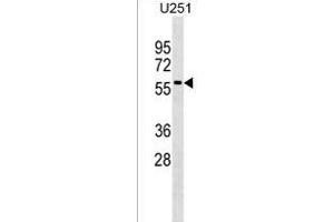 Rab9p40 Antibody (C-term) (ABIN1537097 and ABIN2838354) western blot analysis in  cell line lysates (35 μg/lane). (RABEPK Antikörper  (C-Term))