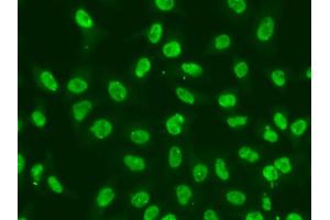 Immunofluorescence analysis of A549 cells using CHEK2 antibody (ABIN5971172). (CHEK2 Antikörper)
