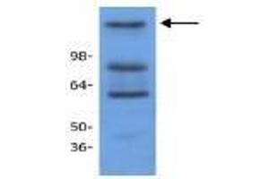 Image no. 1 for anti-Histone Deacetylase 9 (HDAC9) antibody (ABIN127248) (HDAC9 Antikörper)