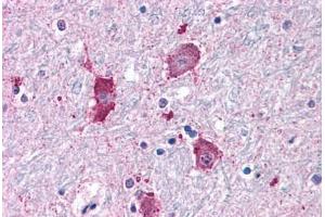 Anti-NPY5R antibody  ABIN1049126 IHC staining of human brain, neurons and glia. (NPY5R Antikörper  (Cytoplasmic Domain))