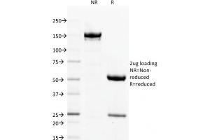 SDS-PAGE Analysis Purified Filaggrin Mouse Monoclonal Antibody (FLG/1563). (Filaggrin Antikörper  (AA 998-1104))