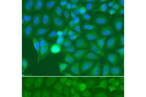 Immunofluorescence analysis of A549 cells using IRAK2 Polyclonal Antibody (IRAK2 Antikörper)
