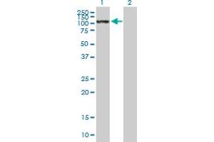 Western Blot analysis of SELE expression in transfected 293T cell line by SELE MaxPab polyclonal antibody. (Selectin E/CD62e Antikörper  (AA 1-610))